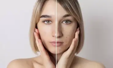9 Langkah Menggunakan Skincare Anti Aging yang Efektif untuk Kulit Awet Muda