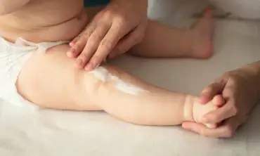 Kulit Belang pada Bayi? Berikut 10 Panduan Merawat Kulitnya yang Masih Sensitif