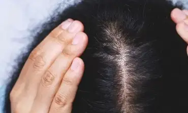 5 Rekomendasi Produk Perawatan Rambut Yang Bisa Membantu Merawat Rambut Kering
